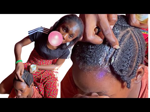 ✨SCALP ✨SCRATCHING ASMR ON A REAL PERSON WITH GUM CRACKING