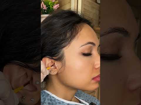 Asmr ear 👂 exam #asmr #relax #relaxing #asmrsounds #asmrvideo #tingles #medical #satisfying #sleep