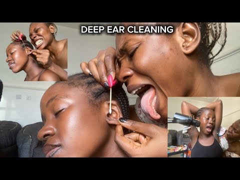 ASMR Deep Ear Cleaning* Ear Flossing, PimplePopping, Head Scratching & Ear Eating for Sleep
