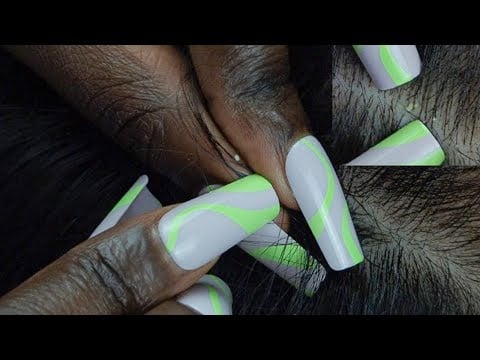 ASMR CLOSE Attentive & Tingly Nitpicking Whiteheads ~ soothing  whispers 💭