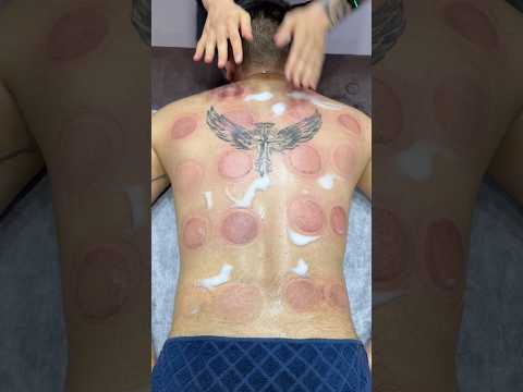 wow pizza cupping😍😂🍕#shorts #cupping #youtubeshorts #massage