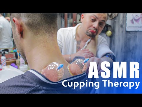 CUPPING | ASMR Cupping Therapy In Barber Shop (asmr head massage + snakestone)