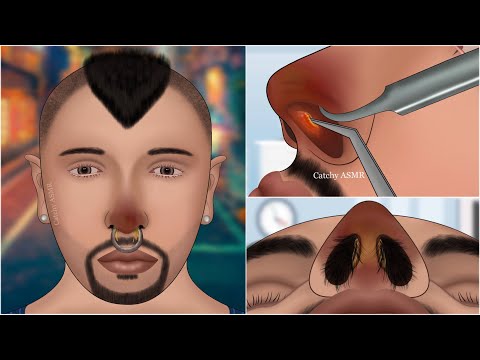 Nose piercing ASMR animation || Nasal septum treatment animation || ASMR