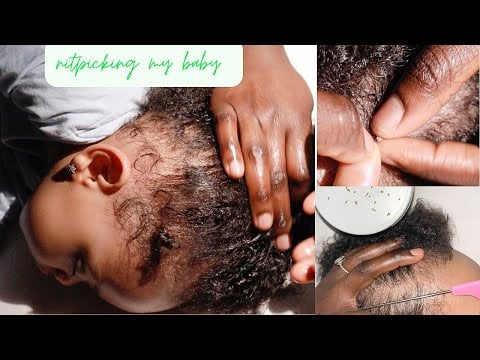 ASMR Rare Insomnia Treatment | Gentle Hairplay, NITPICKING, Parting, Oiling - real baby ☁️