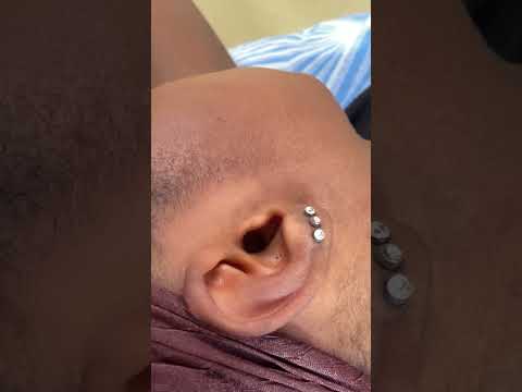 ASMR EAR NITPICKING FOR SLEEP #asmr #satisfying #asmrsounds #earpick