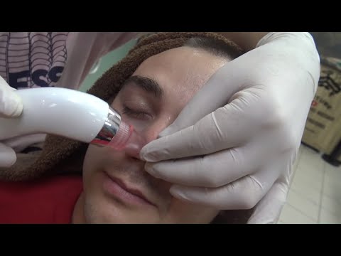 ASMR TURKISH BARBER 💈 ASMR SKIN CARE =EAR BURN=NECK CRACK=haircut=head,face,ear,neck,sleep massage