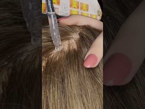 Scalp Treatment 💆🏻‍♀️ #asmr #satisfying #visualtingle #relax #mouthwhisper #relaxing