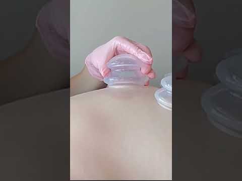 ASMR Back Cupping