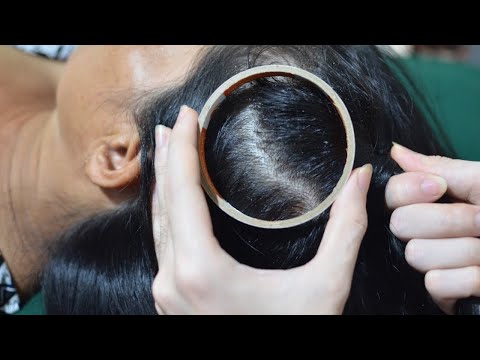 ASMR Head Scratching, Scalp Scratching Sounds For Relieve Stress, Headache ( Asmr No Talking )