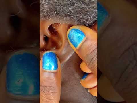 Asmr ear hole nitpicking and cleaning #asmr #relax #tingling #sleepsounds #satisfying