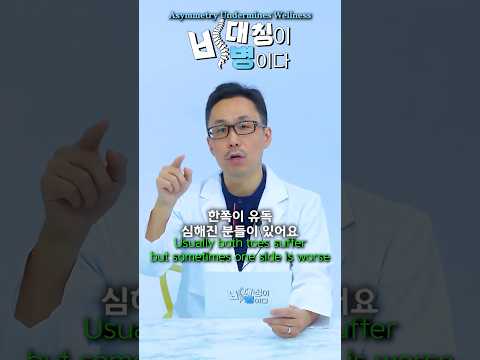 발가락이 휘어지면 수술해야 하나요? (ENG) |  #척추정렬회복술 #SART