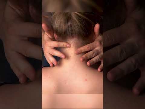 ASMR in Seconds: Fast Scalp & Skin Tracing #shorts #asmr