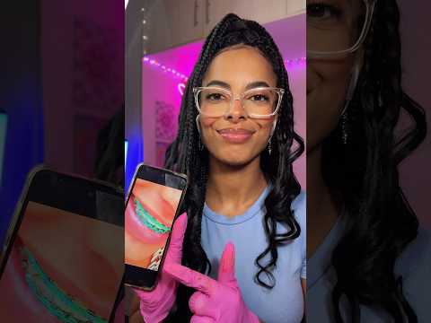 Pov: vc foi no dentista colocar aparelho #asmrbrasil #relax