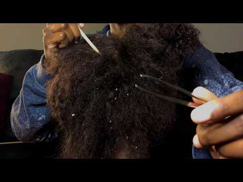 ASMR Flake Plucking w/ Tweezers + Scalp Treatment Roleplay