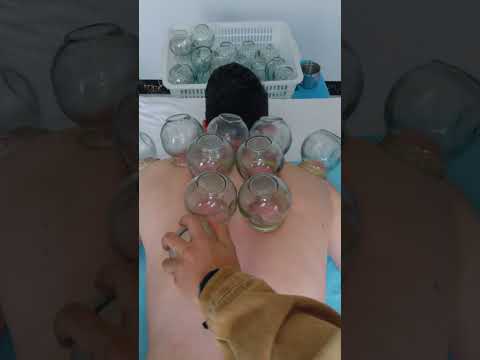ASMR: Insane STRONG Chinese Back Massage and Fire Cupping #shorts