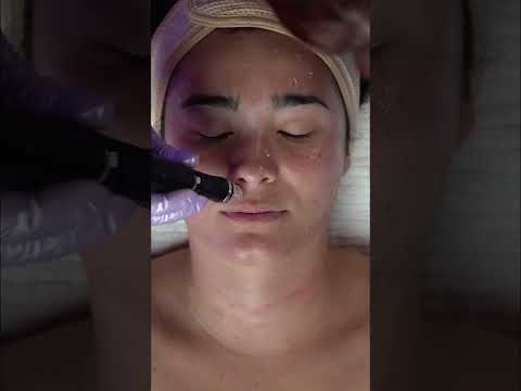 This Facial Wand Treatment Is My Favorite! #shorts