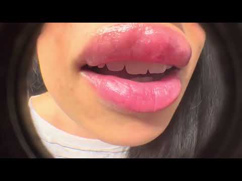 ASMR Help! There’s something on my lip. Mouth sounds fish eyelens