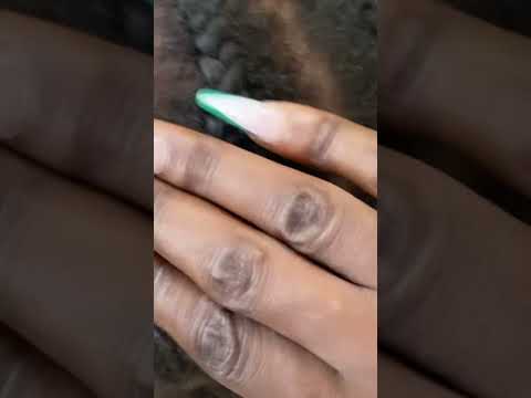 Aggressive scalp Scratching asmr real person #asmr #relax #nails #scratch #scalpcheck