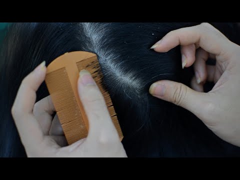 ASMR Scalp Check For Sleep, Scalp Scratching On Real Person ( No Talking Asmr )