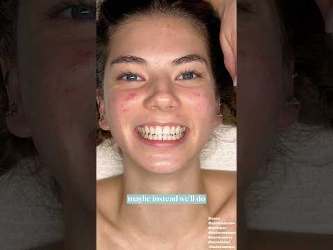 ASMR Facial on ​⁠@katemariess