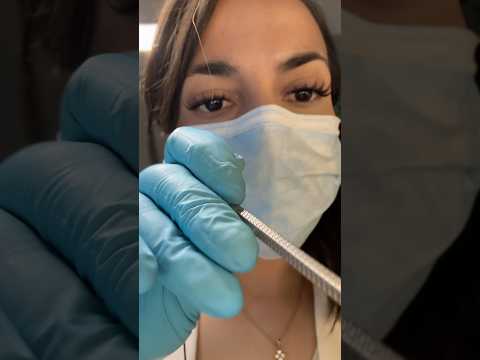 Dentist ASMR 🦷 ✨ #asmr #tingles