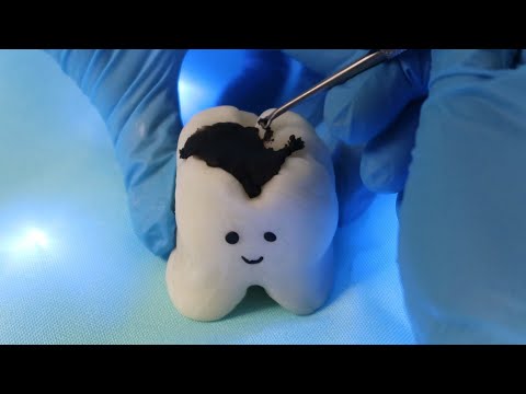 ASMR DENTISTA - LIMPANDO SEU DENTE! 🦷