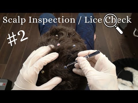 Real person ASMR Scalp Inspection and Lice Check #2 No Talking