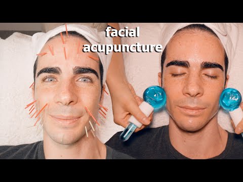 ASMR: Ho Provato L' AGOPUNTURA CINESE sulla FACCIA con un Massaggio FACIAL!
