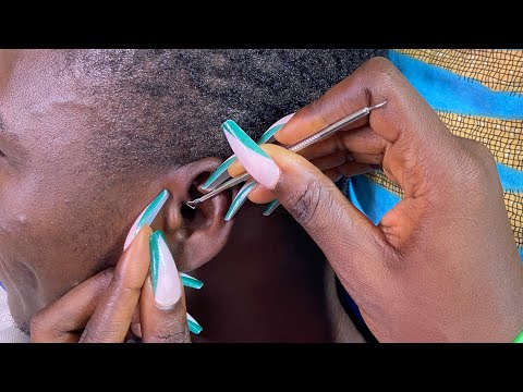 ✨Asmr ✨Real Person Ear Cleaning & picking