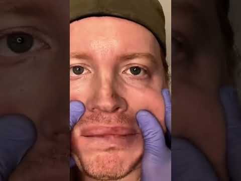ASMR Cranial Nerve Exam From Both Sides