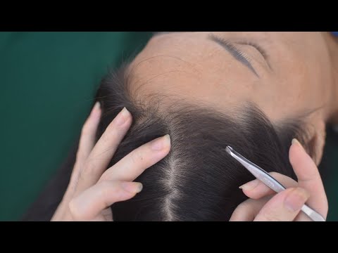 ASMR Tingling Head Scratch Aggressive, Relaxing Hair Parting, Hair Play For Stress Relief
