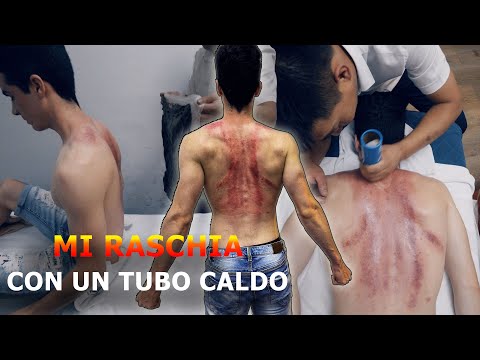 ASMR: HO PROVATO il MASSAGGIO con MOXIBUSTIONE e GUASHA INTEGRATI al LEGNO di AGAR!
