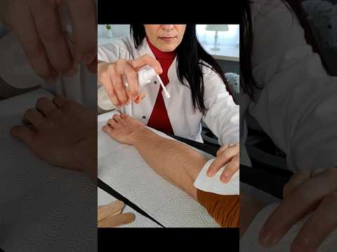 Arm allergy check
