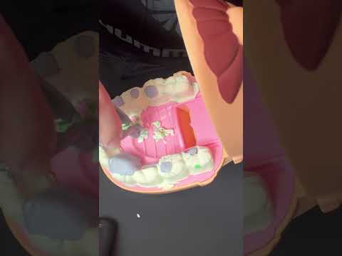 ASMR Short Satisfying Play-Doh Dentist ASMR: Filling Cavities 🦷 Preview