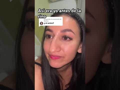Yo antes de la rinoplastia