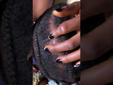 Asmr Scratching between braids #asmr #satisfying #nitpicking #skincare