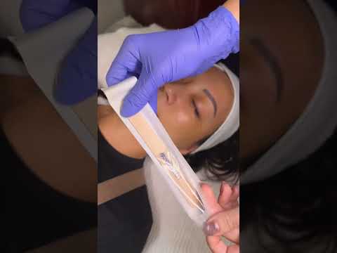 This peel 🤝 pigmentation #asmr #facial #skincare #medspa