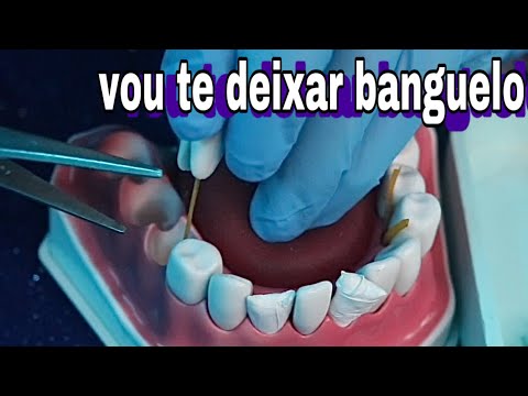 ASMR | EXTRAINDO TODOS OS SEUS DENTES !