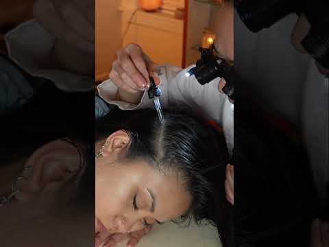 Asmr scalp 💆🏻‍♀️ #asmr #asmrsounds #asmrvideo #relax #relaxing #satisfying #hair #tingles #sleep