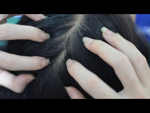 ASMR Head Scratching, Scalp Scratching Sounds For Relieve Stress, Itchy ( No Talking )