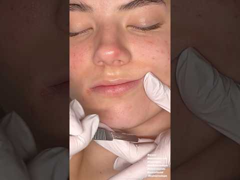 ASMR Dermaplaning on ​⁠@katemariess