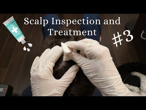 Real Person ASMR Scalp Check, Lice Check and Scalp Treatment #3 No Talking