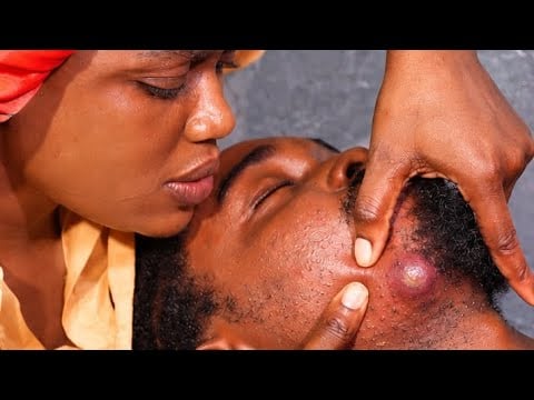 Asmr✨satisfying pimple pop,beard nitpicking, ineck massage, scalp and head massage with gum cracking