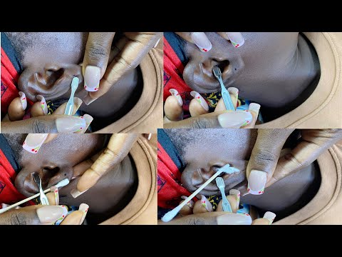 ASMR SATISFYING EAR NITPICKING AND CLEANING FOR ULTIMATE RELAXATION