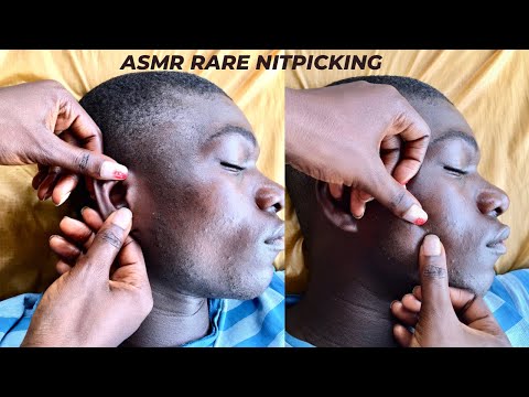 A rare and attentive face Nitpicking Asmr #asmr #nitpicking