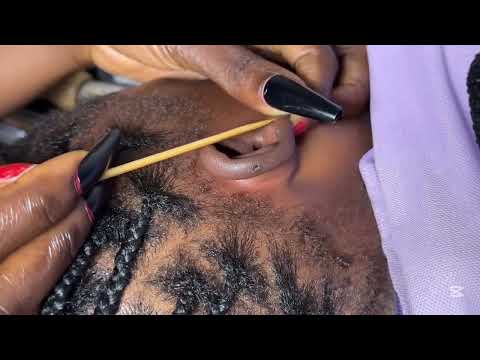 ASMR SATISFYING DEEP EAR CLEANING COMPILATION FOR THOSE WHO NEED TINGLES TO SLEEP RIGHT NOW