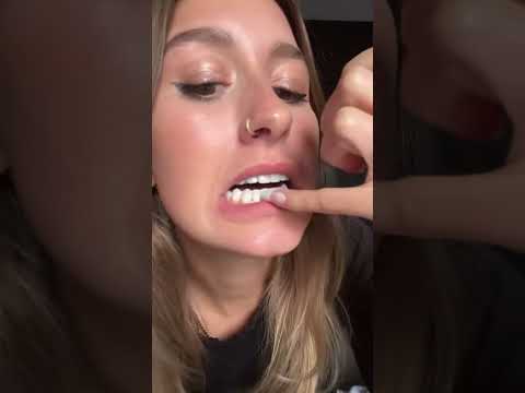 Do you like my teeth?