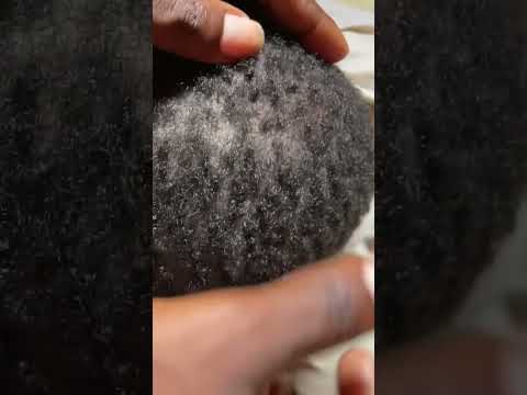 Asmr Scratching and oiling scalp with whispers #asmr #tingling #satisfying  #scratch