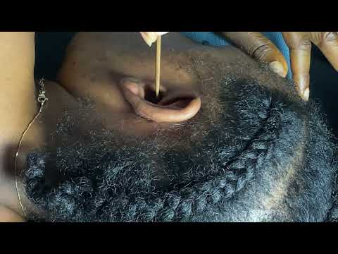 ASMR Ear Cleaning, Back Scratching, Scalp Scratching Sleep Doctor Roleplay for Deep Sleep & Tingles