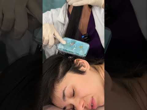 Asmr scalp tingles #asmr #asmrsounds #asmrvideo #relax #relaxing #satisfying #hair #sleep #tingles